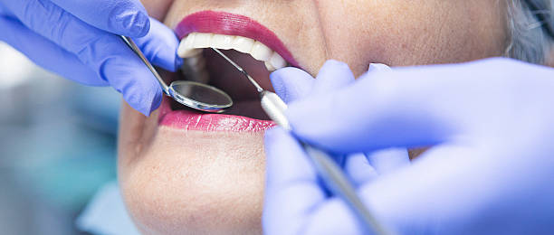 Best Emergency Dental Care for Broken or Chipped Teeth in Shelton, WA